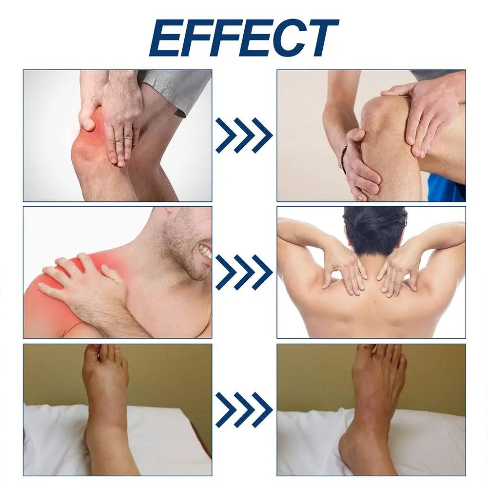 3pcs Bee Joint Pain Care Cream Relieve Lumbar and Knee Muscle Soreness Tratamiento Arthritis Sciatica Health Care - Path to Self-Improvement