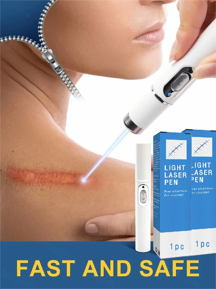 Laser Therapy Keloid Scar Improve Keloid Scar Pen Scar Relief Easy Harmless Laser Pointer - Path to Self-Improvement