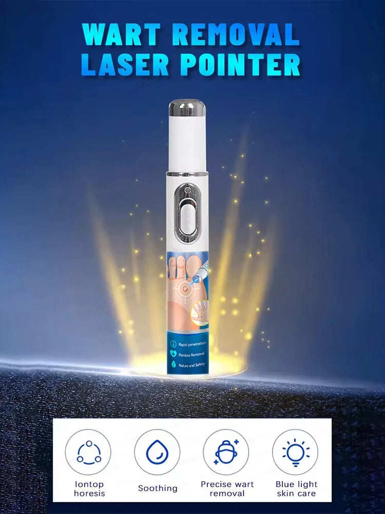 Quick and painless removal of warts, the latest generation blue light laser pen, hot-selling package - Path to Self-Improvement