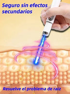 Laser Therapy Keloid Scar Improve Keloid Scar Pen Scar Relief Easy Harmless Laser Pointer - Path to Self-Improvement