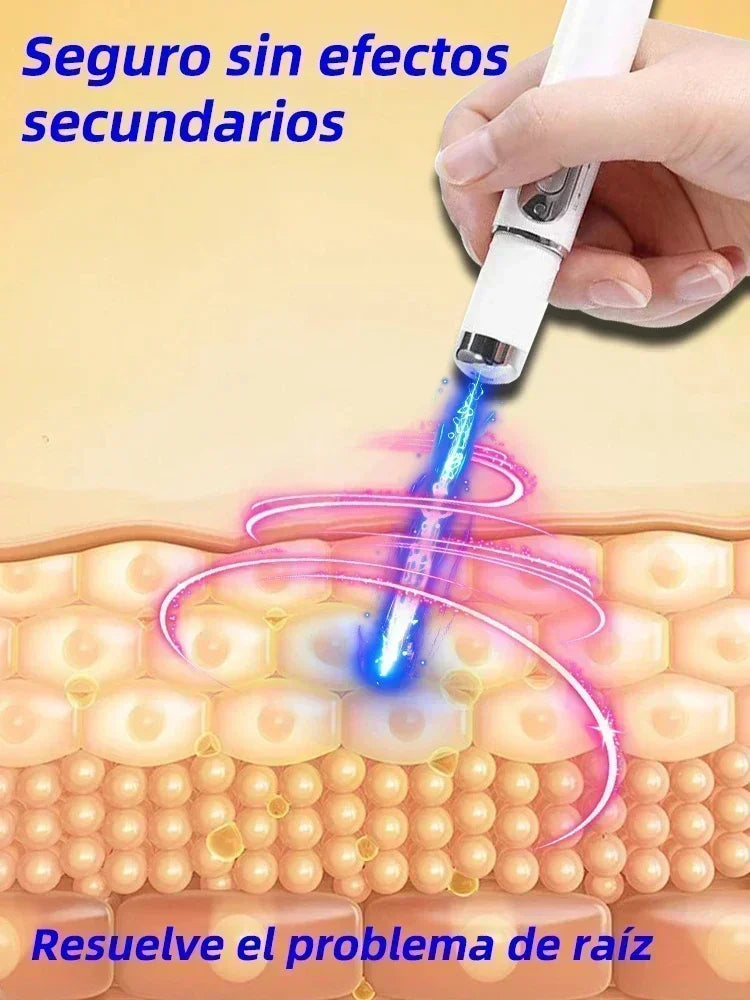 Laser Therapy Keloid Scar Improve Keloid Scar Pen Scar Relief Easy Harmless Laser Pointer - Path to Self-Improvement