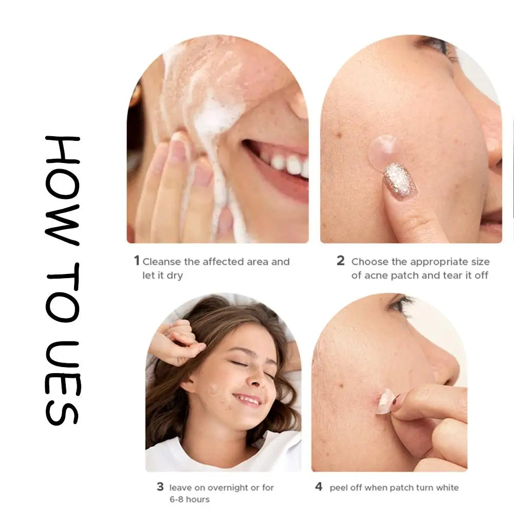 Hydrocolloid Patch Acne Invisible Pimple Removal Multi-shape Mixing  Full Face Pimple Patches Beauty Makeup Face Care - Path to Self-Improvement