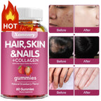 Hair, Skin & Nails Gummies | Hair Vitamins for Men and Women | Biotin Supplements - Path to Self-Improvement
