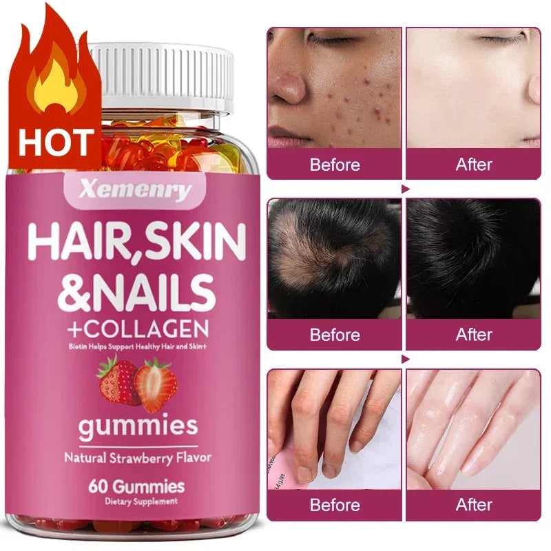 Hair, Skin & Nails Gummies | Hair Vitamins for Men and Women | Biotin Supplements - Path to Self-Improvement