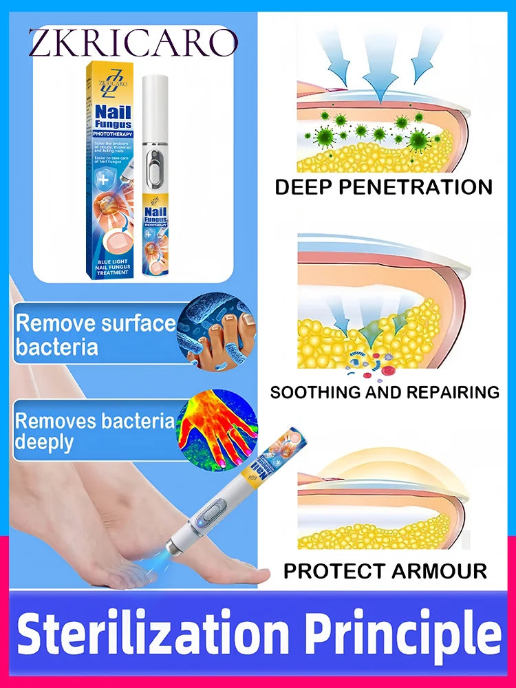 2025 Hot Sellers: Nail Cleaning Tools, Blue Light Laser Tools Root Repair Upgraded to Second Generation - Path to Self-Improvement